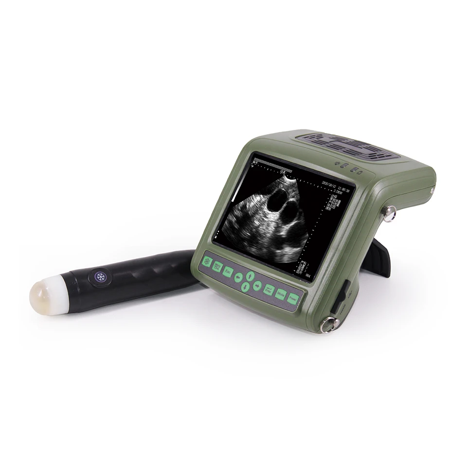 Portable Ultrasound Machine